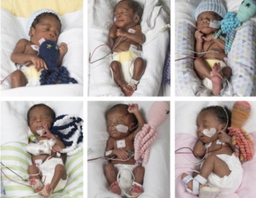 Nigerian woman gives birth to sextuplets in U.S hospital