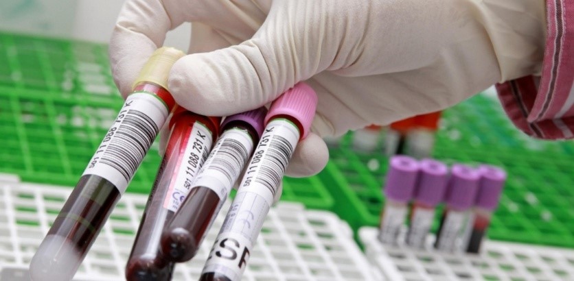 Germans develop breast cancer blood test