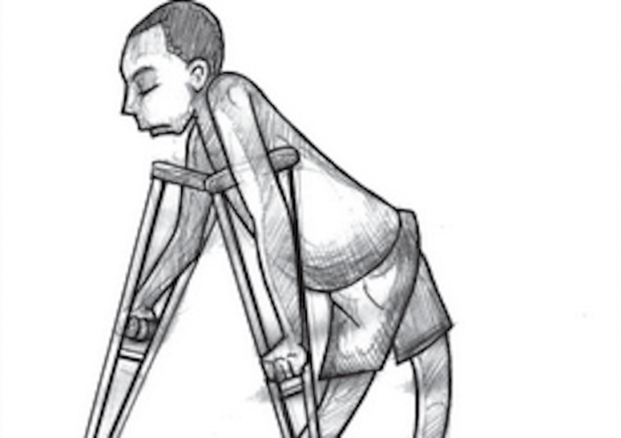 Fresh concerns over polio – Thisday