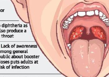 Battling the diphtheria outbreak – Vanguard