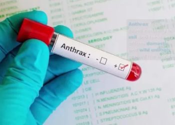 Nigeria confirms first anthrax case