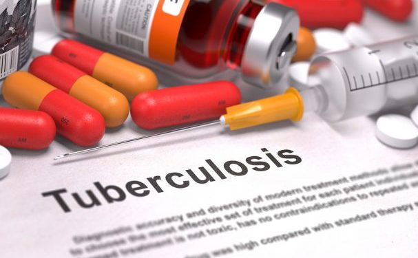 Halting tuberculosis’ dangerous march – Punch