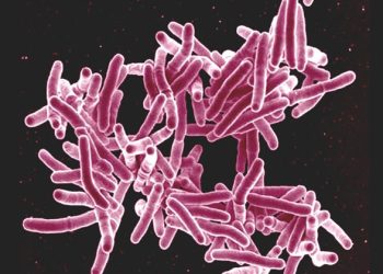 World TB testing: Plateau records over 2,000 TB cases in six months