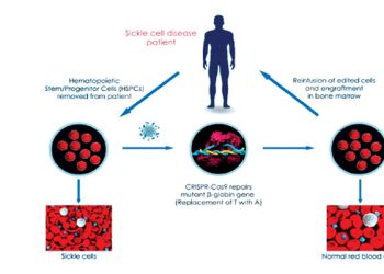 Rising hope for sickle cell carriers over gene editing therapy