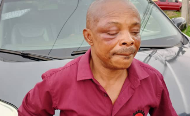 One dies in Imo protest as police brutalize, arrest NLC President