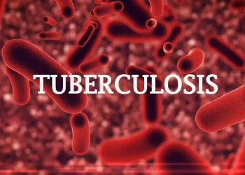300 die of tuberculosis in Ogun State