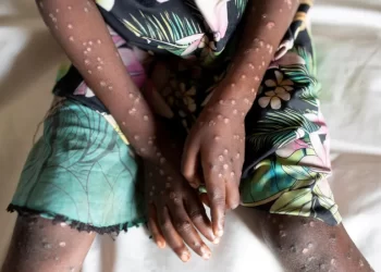 WHO declares mpox global health emergency