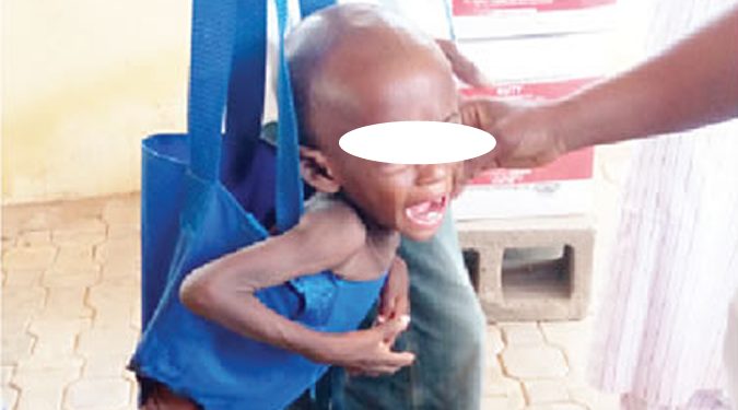 Nigeria’s child malnutrition crisis – Punch