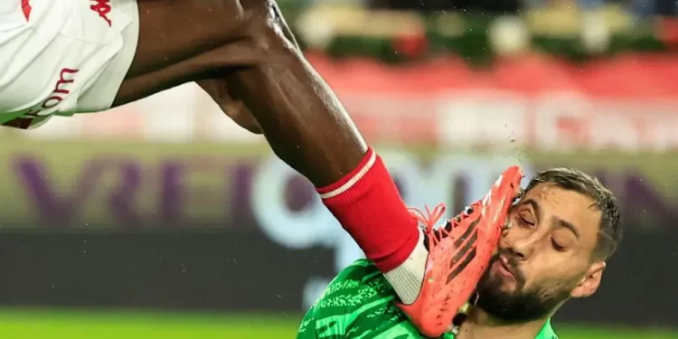 Donnarumma suffers nasty facial injury in PSG win