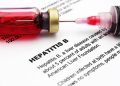 Hepatitis: Rescuing Nigerians from needless deaths – Punch